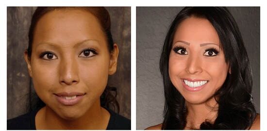 before-after-casandra side by side
