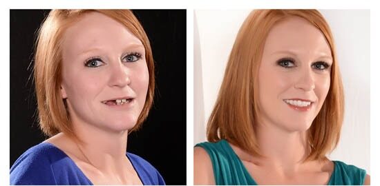 before-after-chelsey side by side