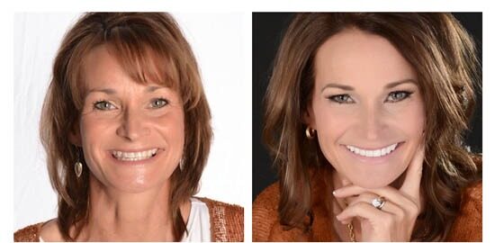 before-after-dwana side by side