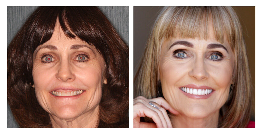 before-after-jennifer side by side