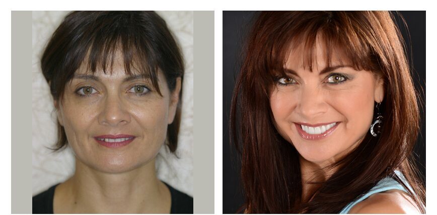 before-after-leticia side by side