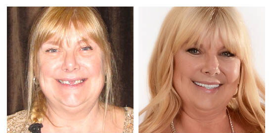 before-after-maryjo side by side