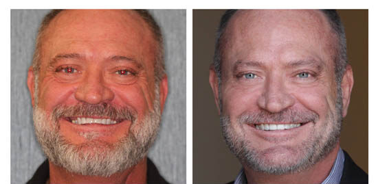 before-after-rick side by side