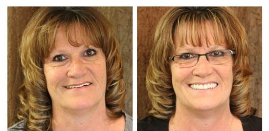 before-after-sandra side by side