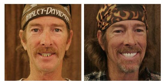 before-after-tim side by side