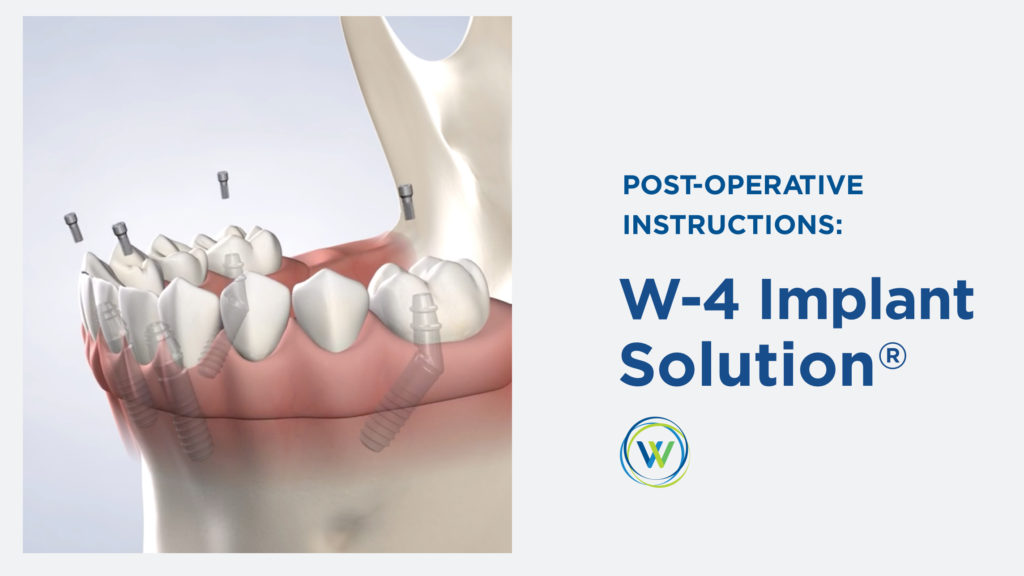 instructions-w-4-implant-solution text on the right and left 3d image of an implant