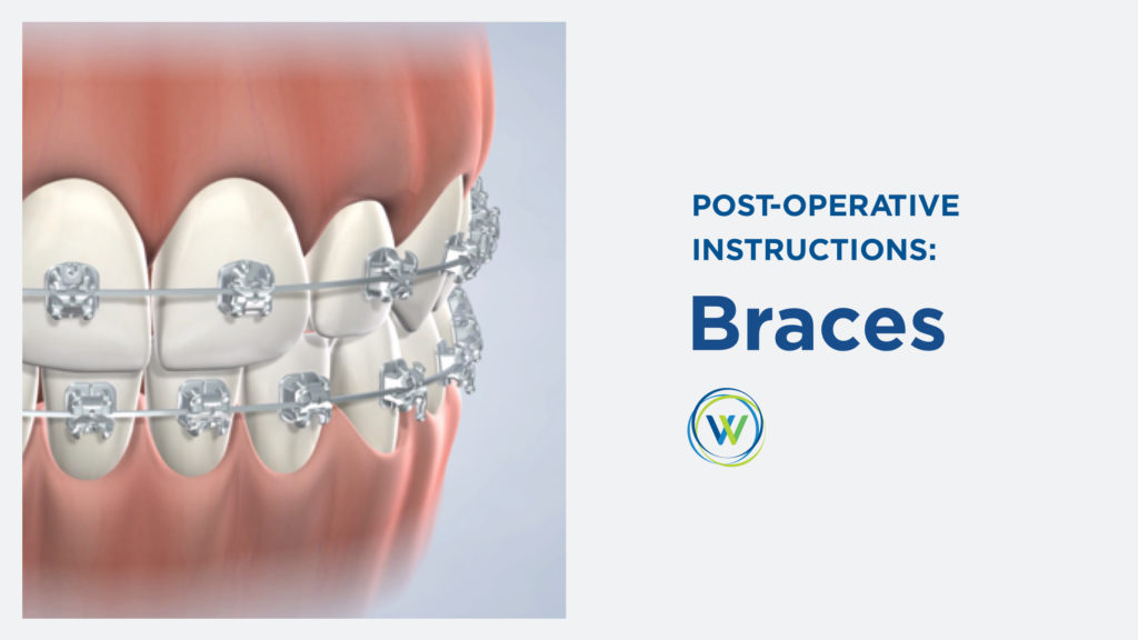 post operative instructions graphic with winterholler logo