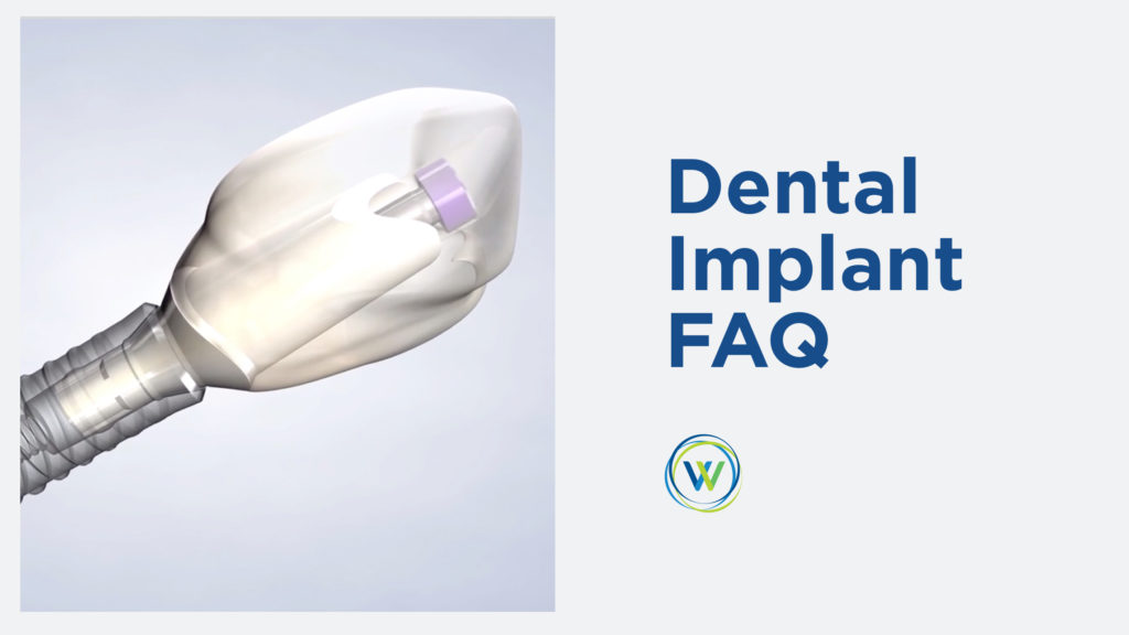 procedure-dental-implant-FAQ text on the right and implant on the left