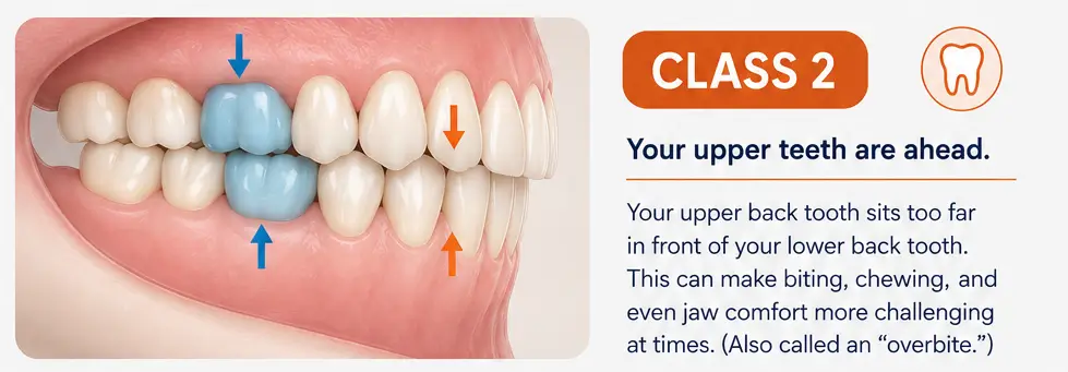 class 2 bite graphic with text on the right and teeth graphic on the left