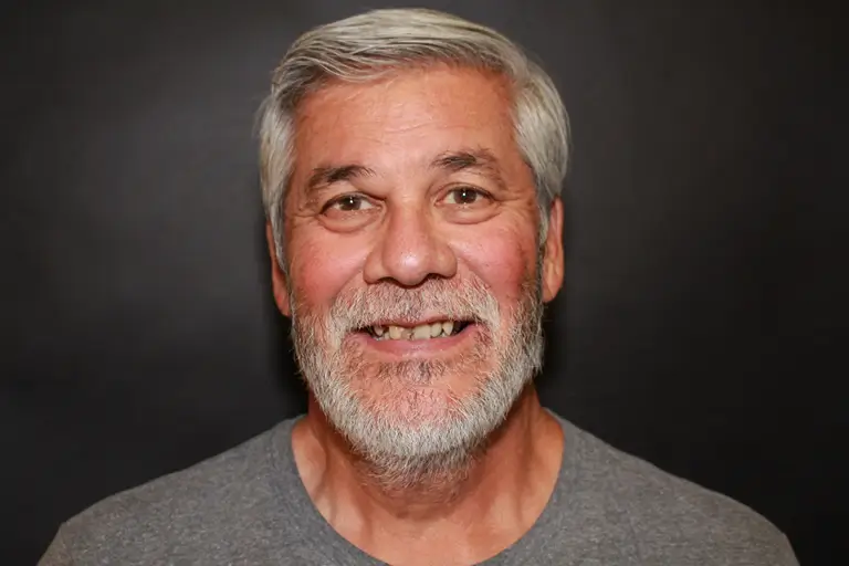 man smilling before surgery