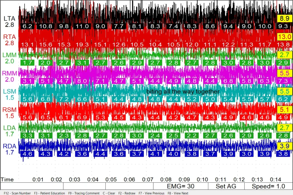 Results chart