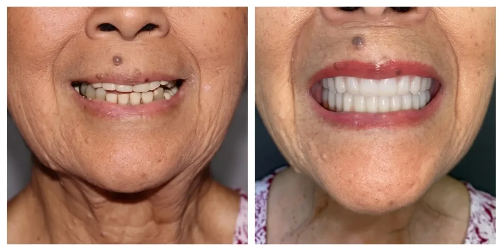 before-after side by side