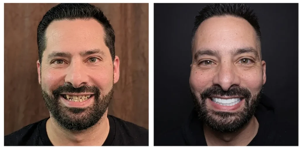 before and after of a male patient