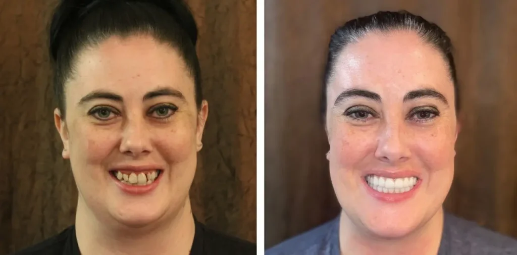 before-after side by side