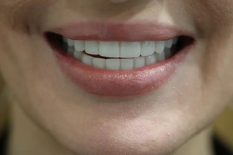 smilling patient after surgery