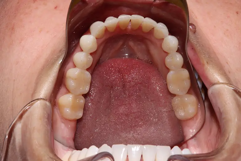 picture of a bottom of a teeth