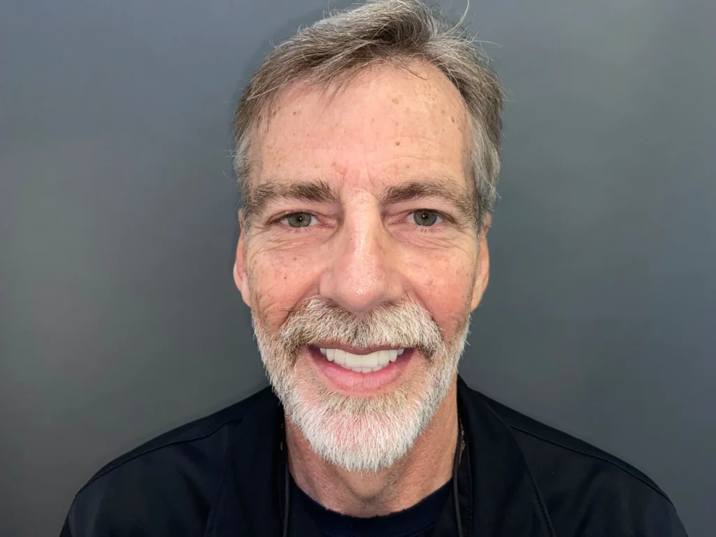 smilling patient after surgery