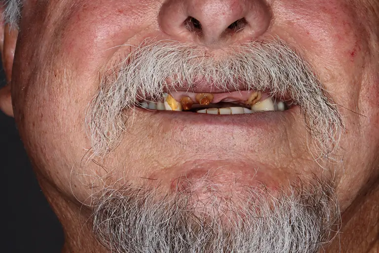 client smilling before surgery