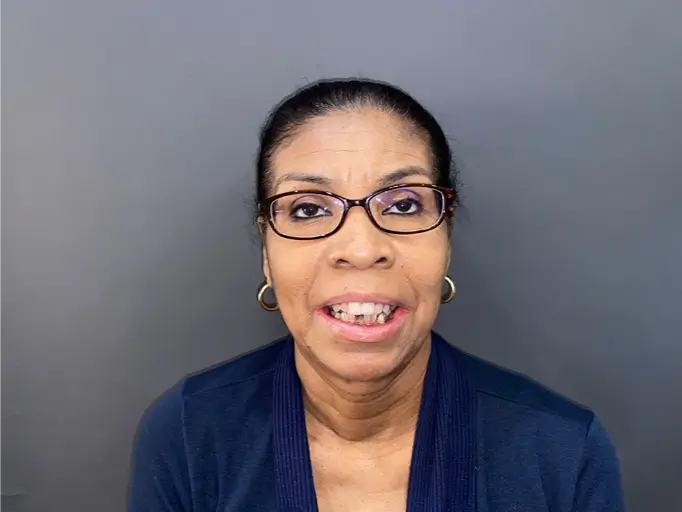 smilling patient before surgery