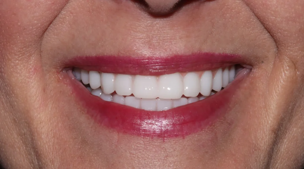 smilling patient after surgery