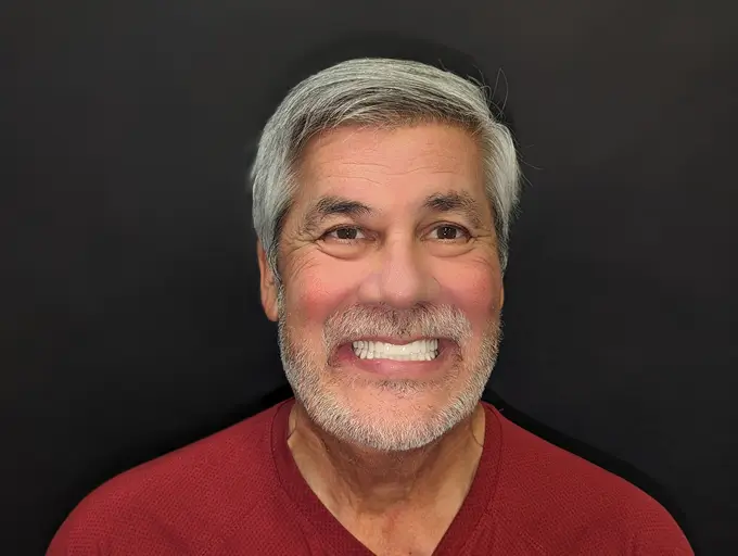 client smilling after surgery