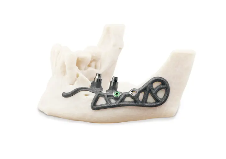 Metal bone attachment for implants
