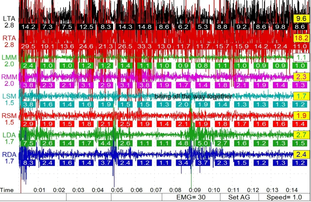 Results chart