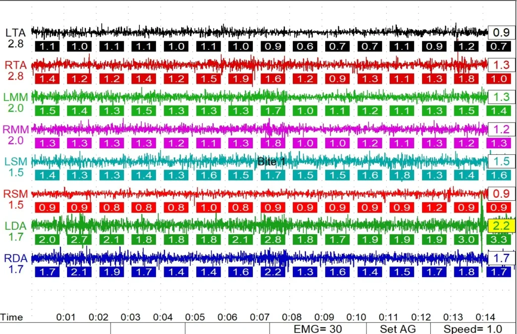 Results chart