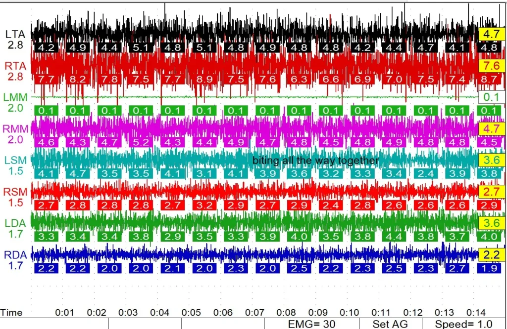 Results chart