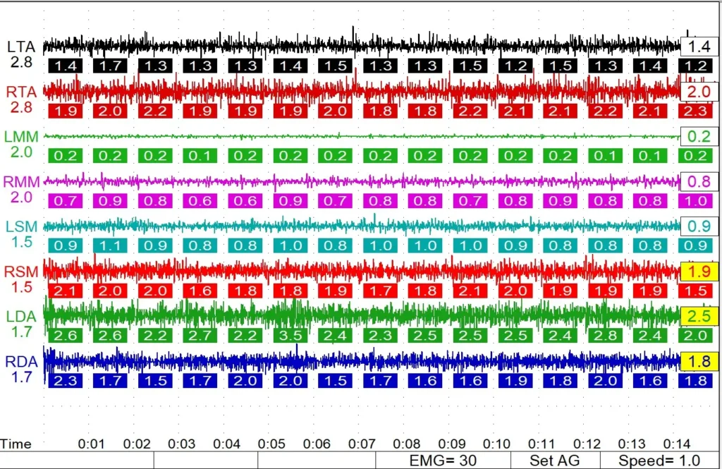 Results chart