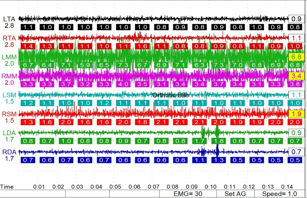 Results chart