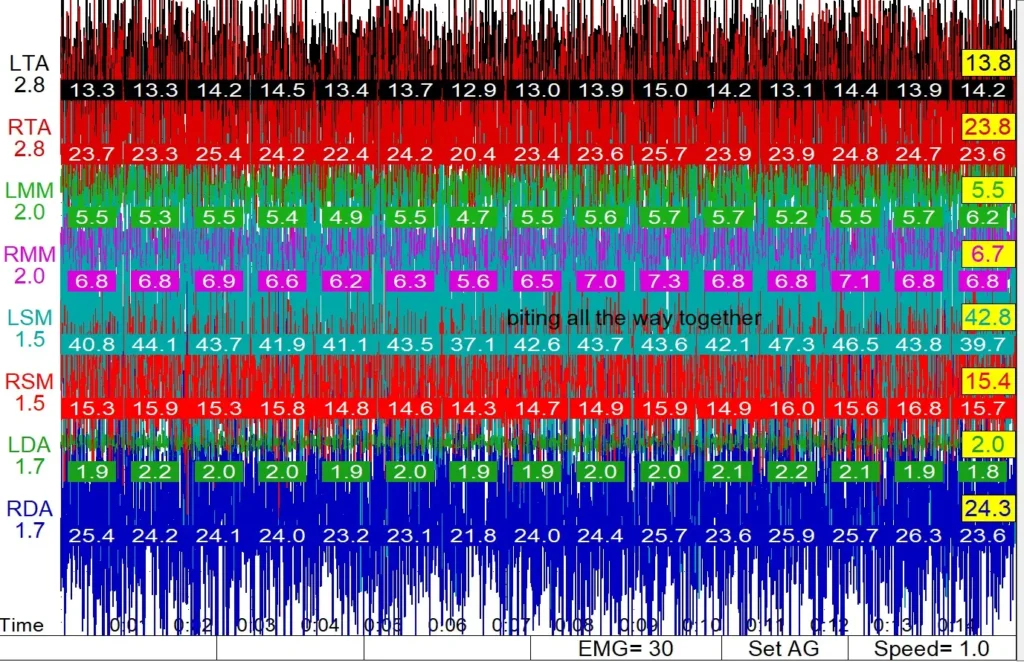 Results chart