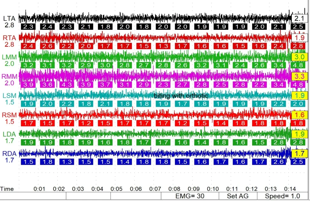 Results chart