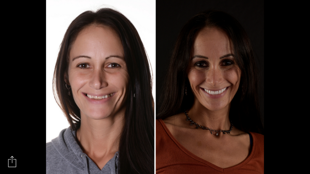 dental implants dr winterholler